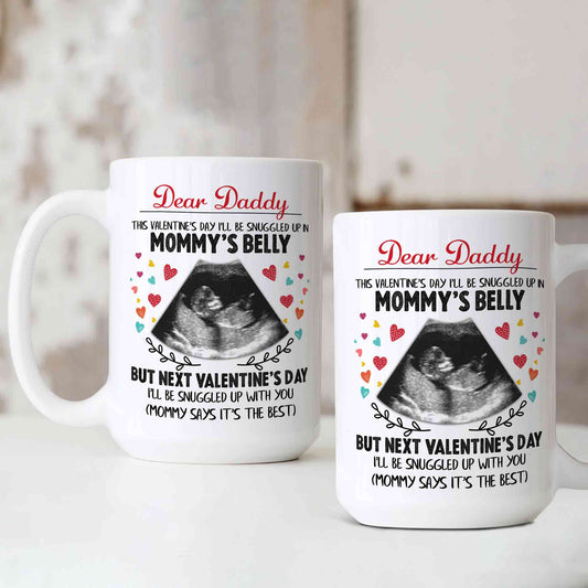 Personalized Sonogram Mug, Ultrasound Photo Gift Mug, Dear Daddy Mug, Pregnancy Announcement for Dad, Dad To Be Gift, New Dad Gift